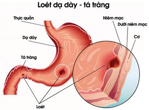 Sinh lý - Nội tiết tố